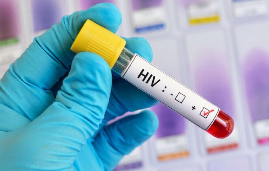 ارائه خدمات درمانی رایگان به بیماران مبتلا به عفونت اچ آی وی(HIV) در هرمزگان