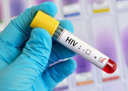 ارائه خدمات درمانی رایگان به بیماران مبتلا به عفونت اچ آی وی(HIV) در هرمزگان